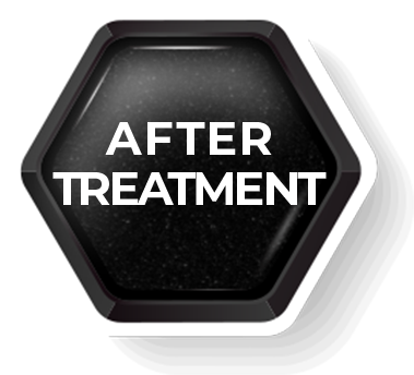 Aftertreatment